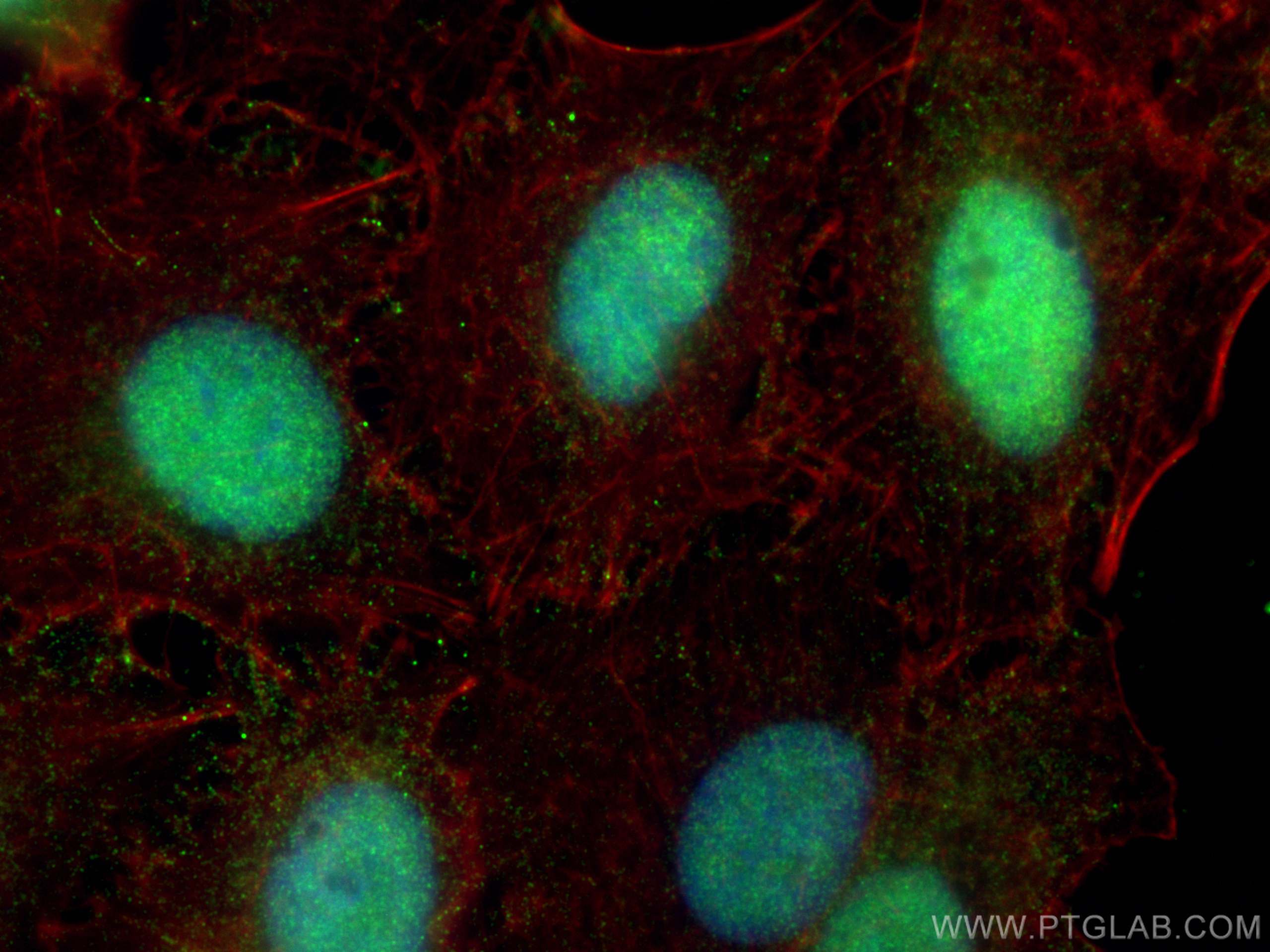 IF Staining of A549 using 67541-1-Ig (same clone as 67541-1-PBS)