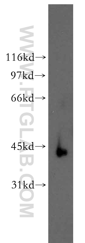 WB analysis of mouse skin using 13166-1-AP