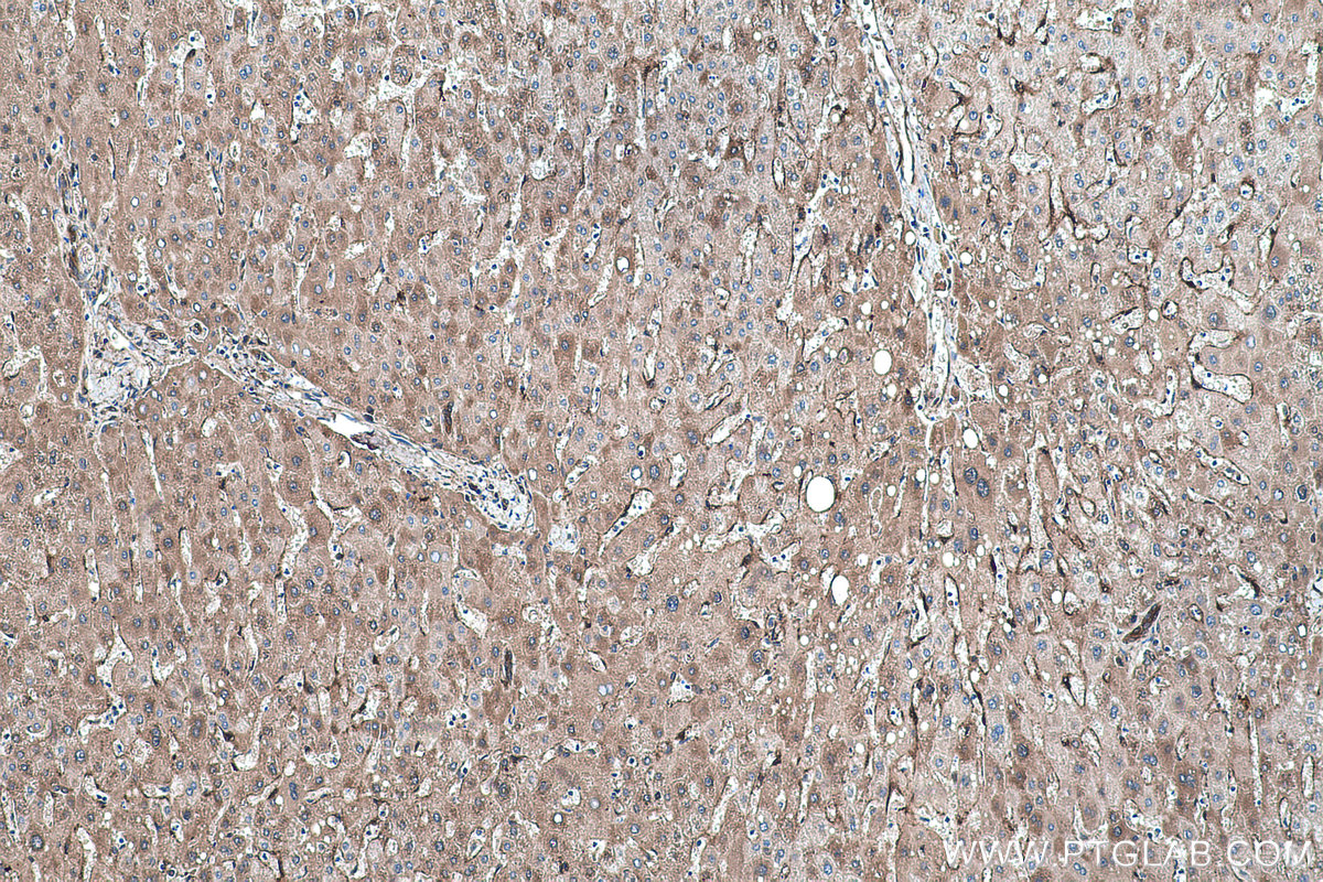 IHC staining of human liver using 22683-1-AP