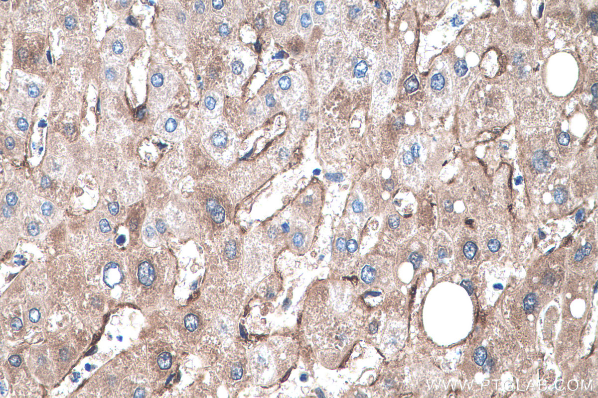 IHC staining of human liver using 22683-1-AP