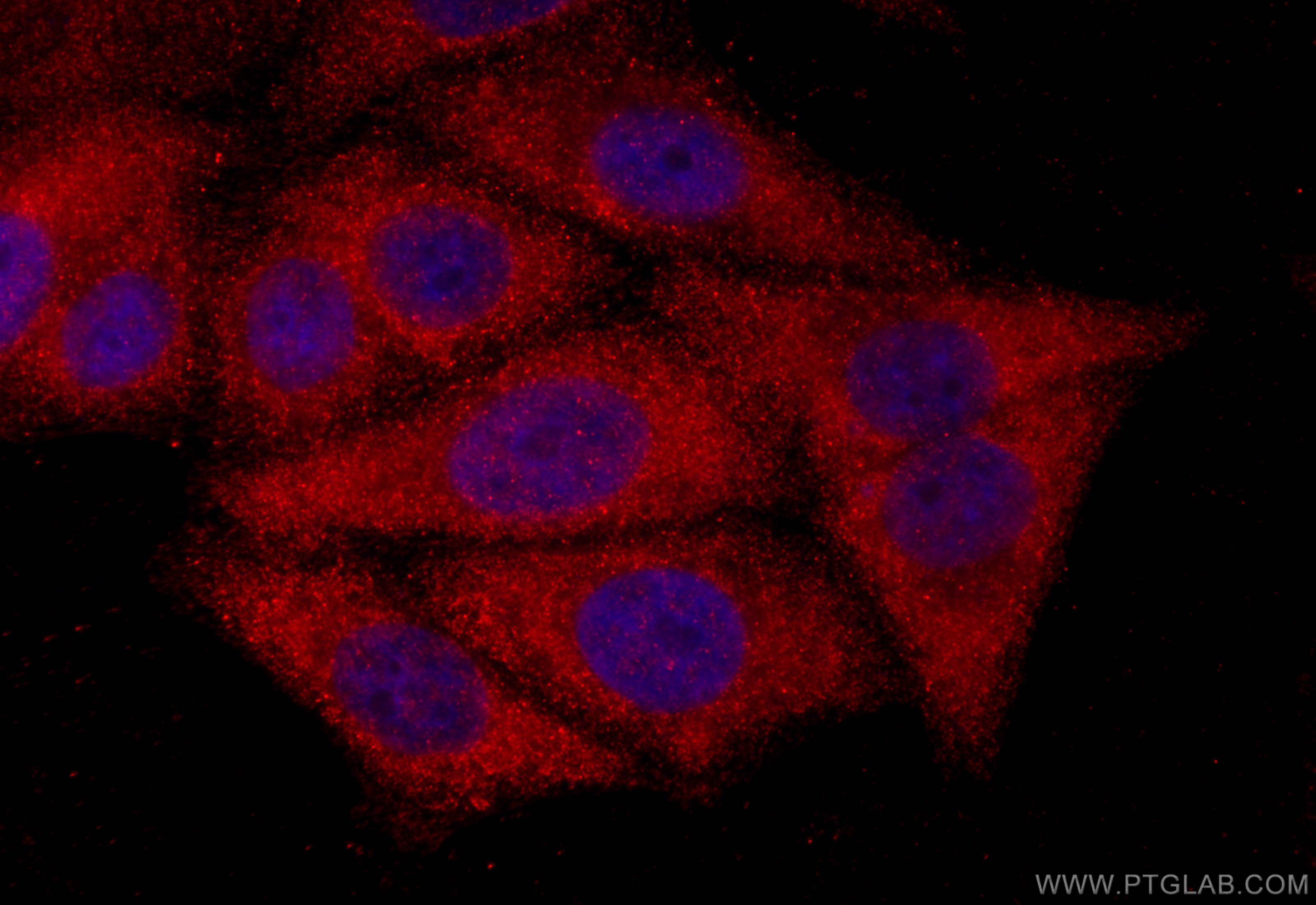 IF Staining of HepG2 using 11843-1-AP