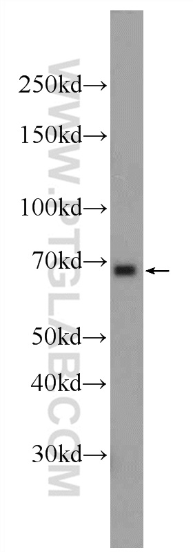 WB analysis of Jurkat using 24664-1-AP