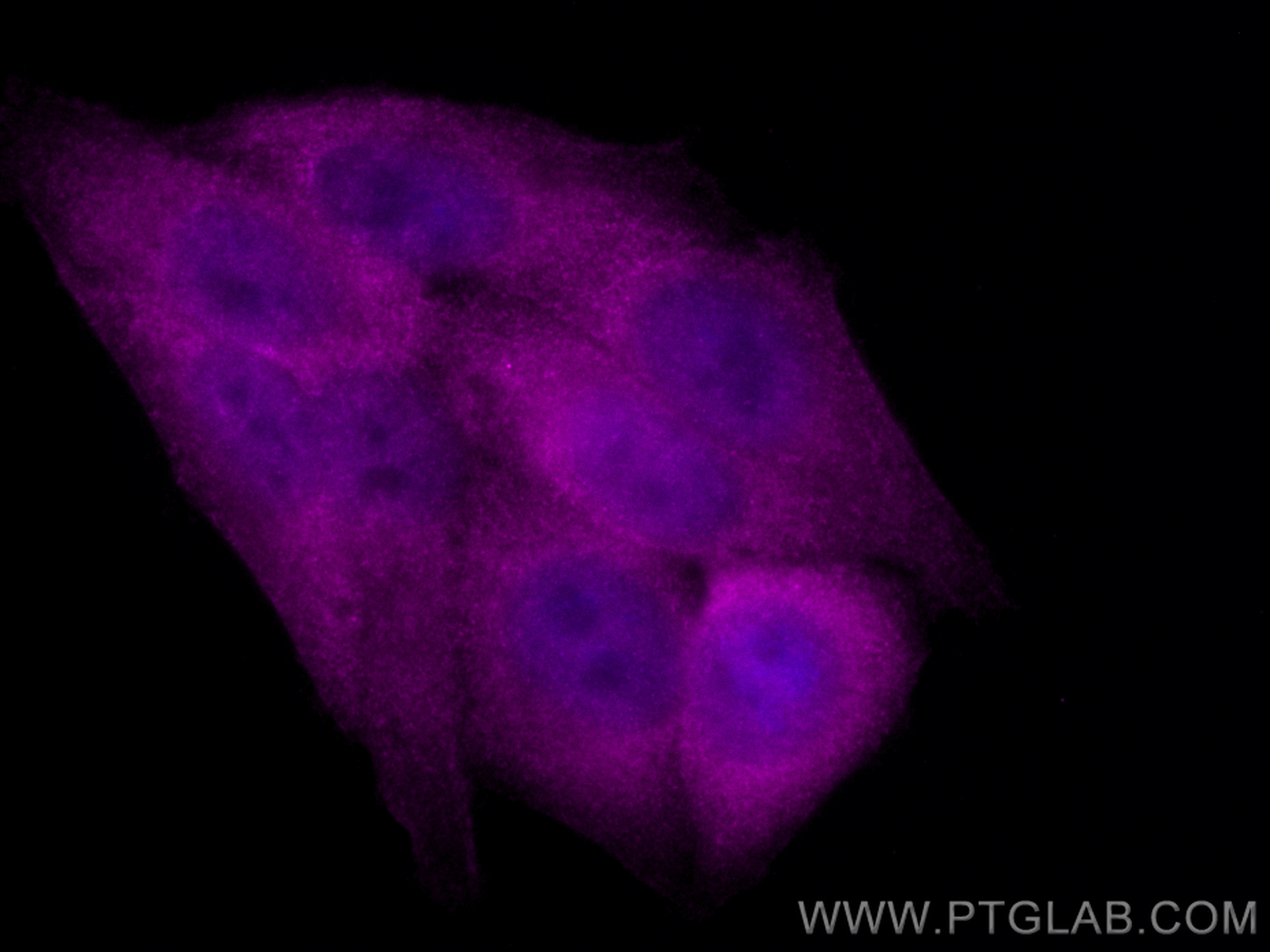 IF Staining of HepG2 using CL647-15187