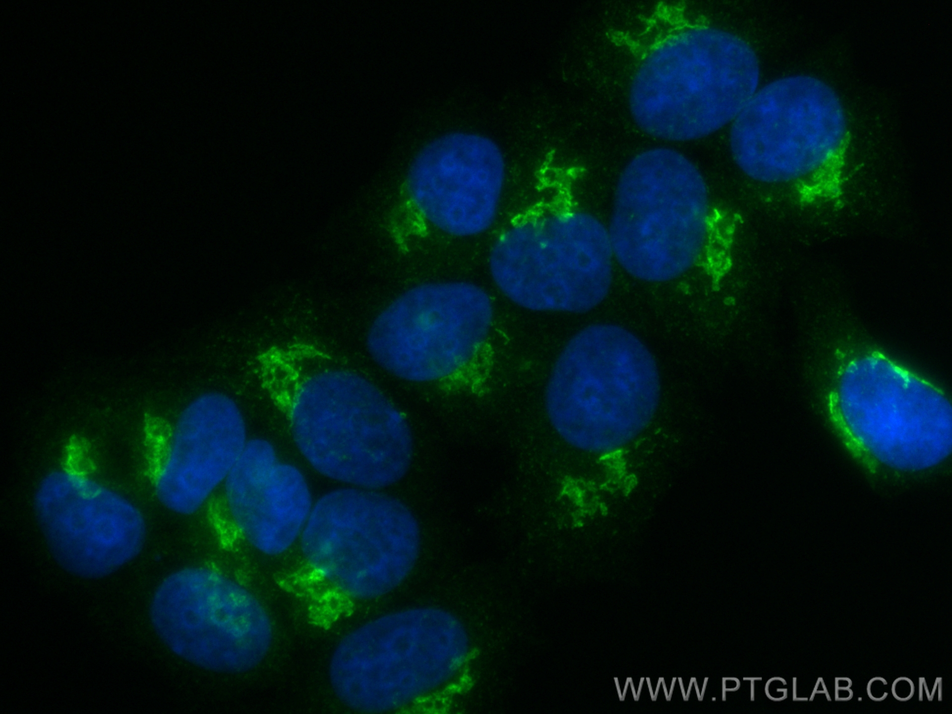 IF Staining of MCF-7 using CL488-12255