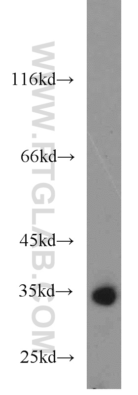 WB analysis of K-562 using 55255-1-AP