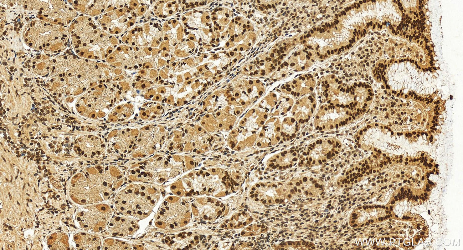 IHC staining of human stomach using 22142-1-AP