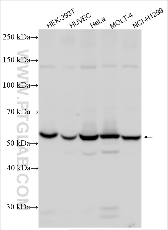 WB analysis using 16755-1-AP