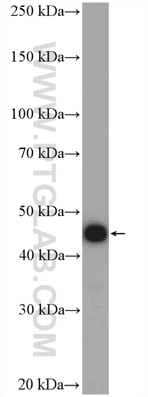 WB analysis of A431 using 15330-1-AP