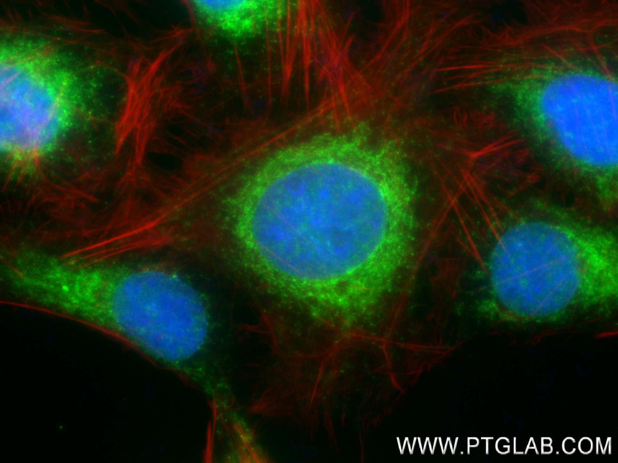 IF Staining of U2OS using 83638-3-RR (same clone as 83638-3-PBS)