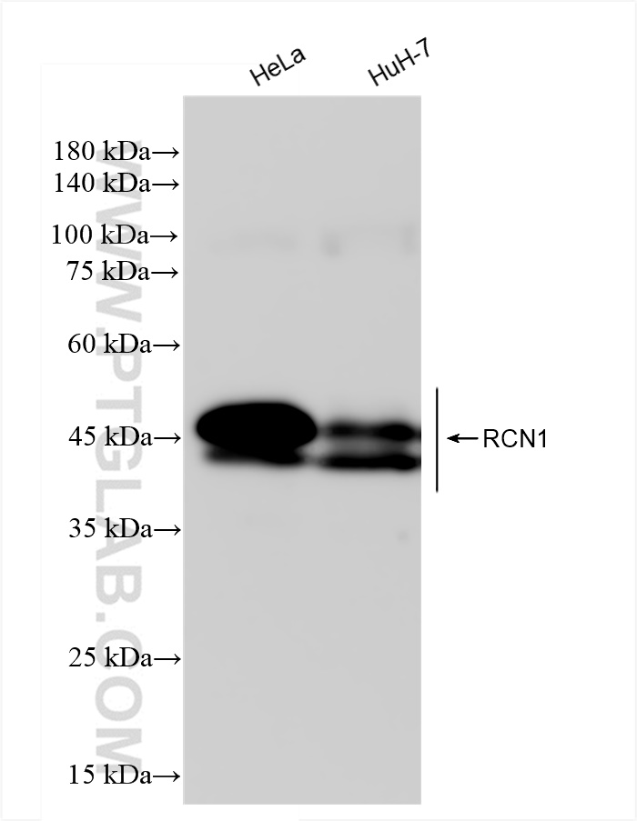 WB analysis using 83638-3-RR (same clone as 83638-3-PBS)