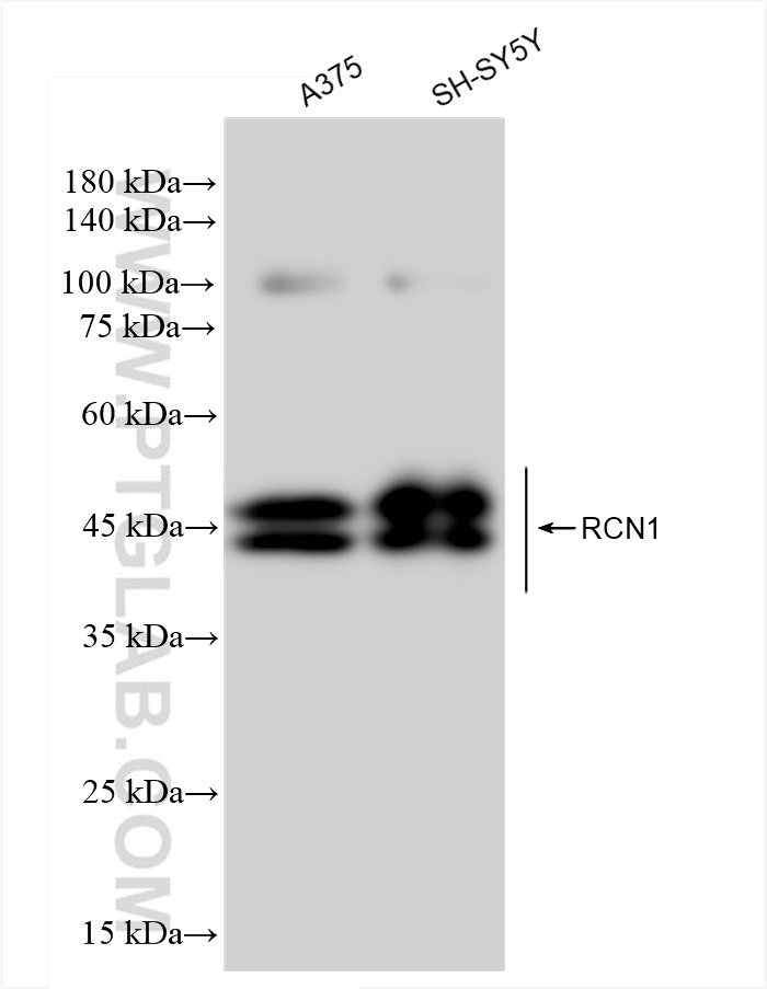 WB analysis using 83638-3-RR (same clone as 83638-3-PBS)