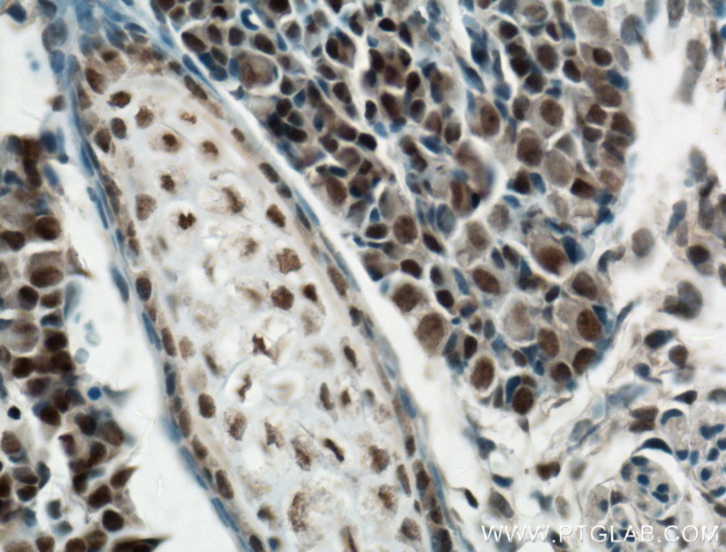 IHC staining of mouse embryo using 23969-1-AP