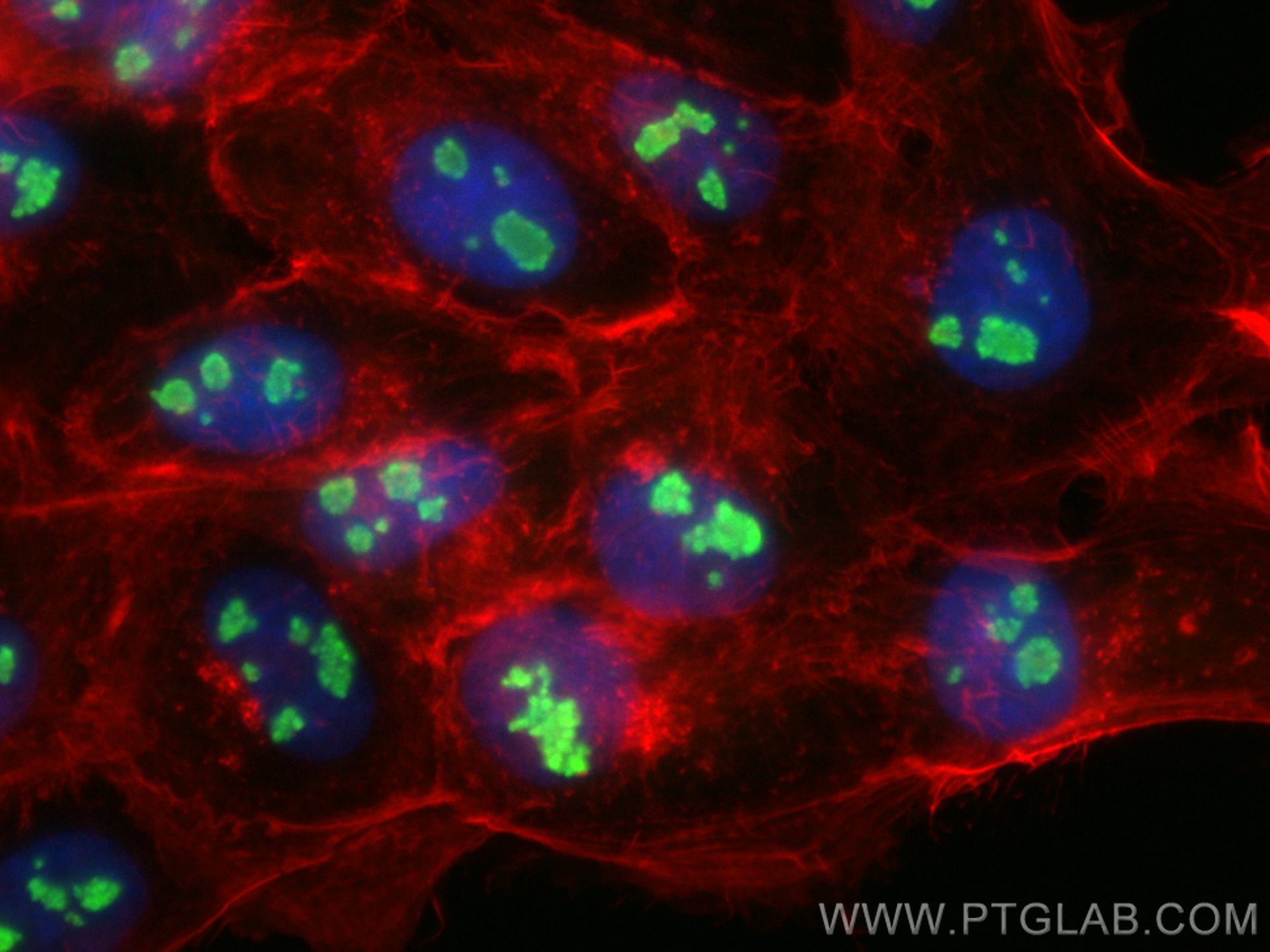 IF Staining of A431 using 55173-1-AP