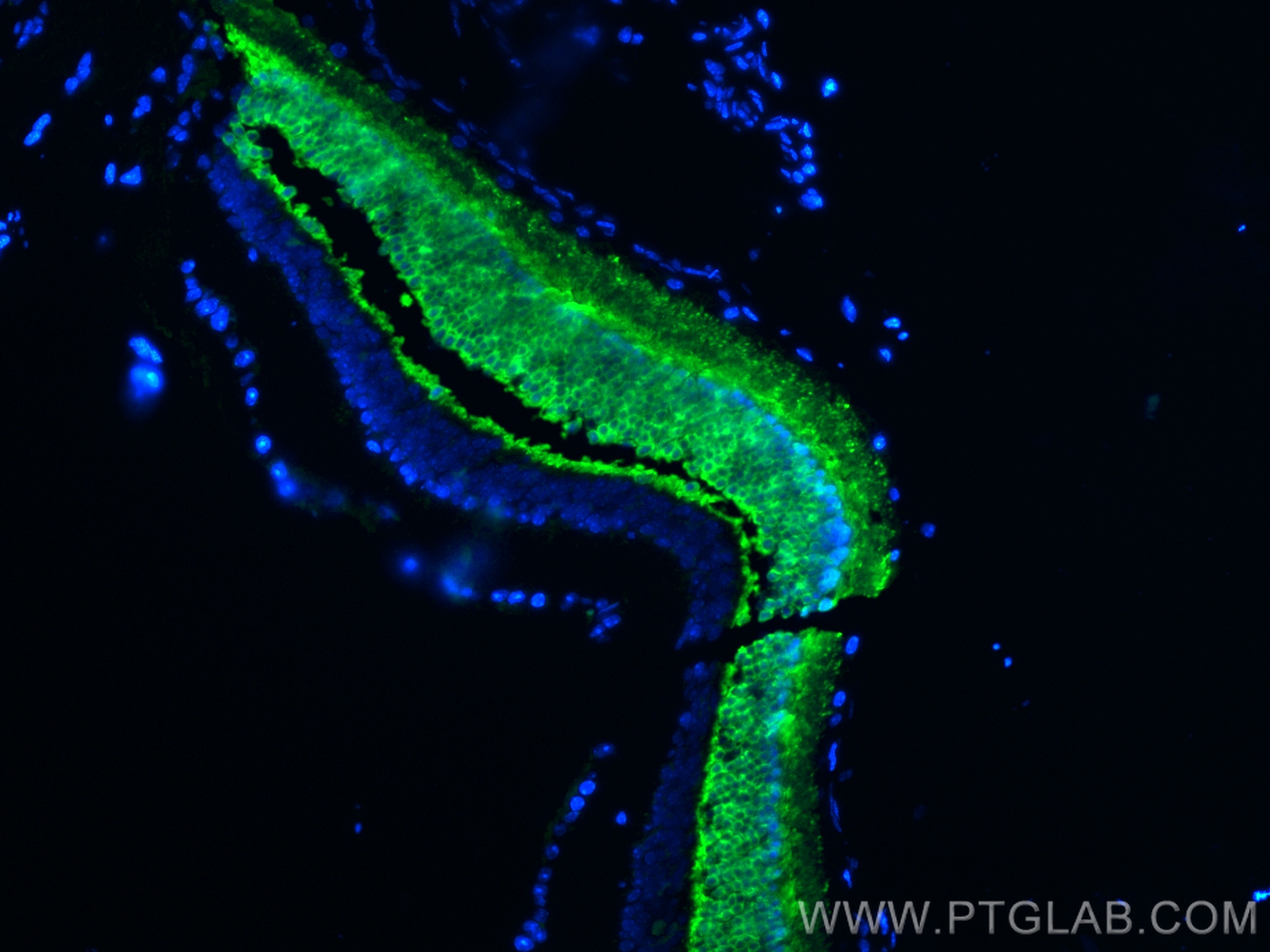 IF Staining of mouse eye using 10073-1-AP