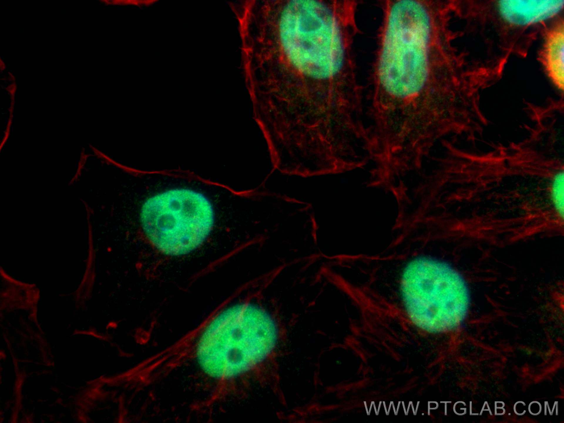 IF Staining of HeLa using 10705-1-AP