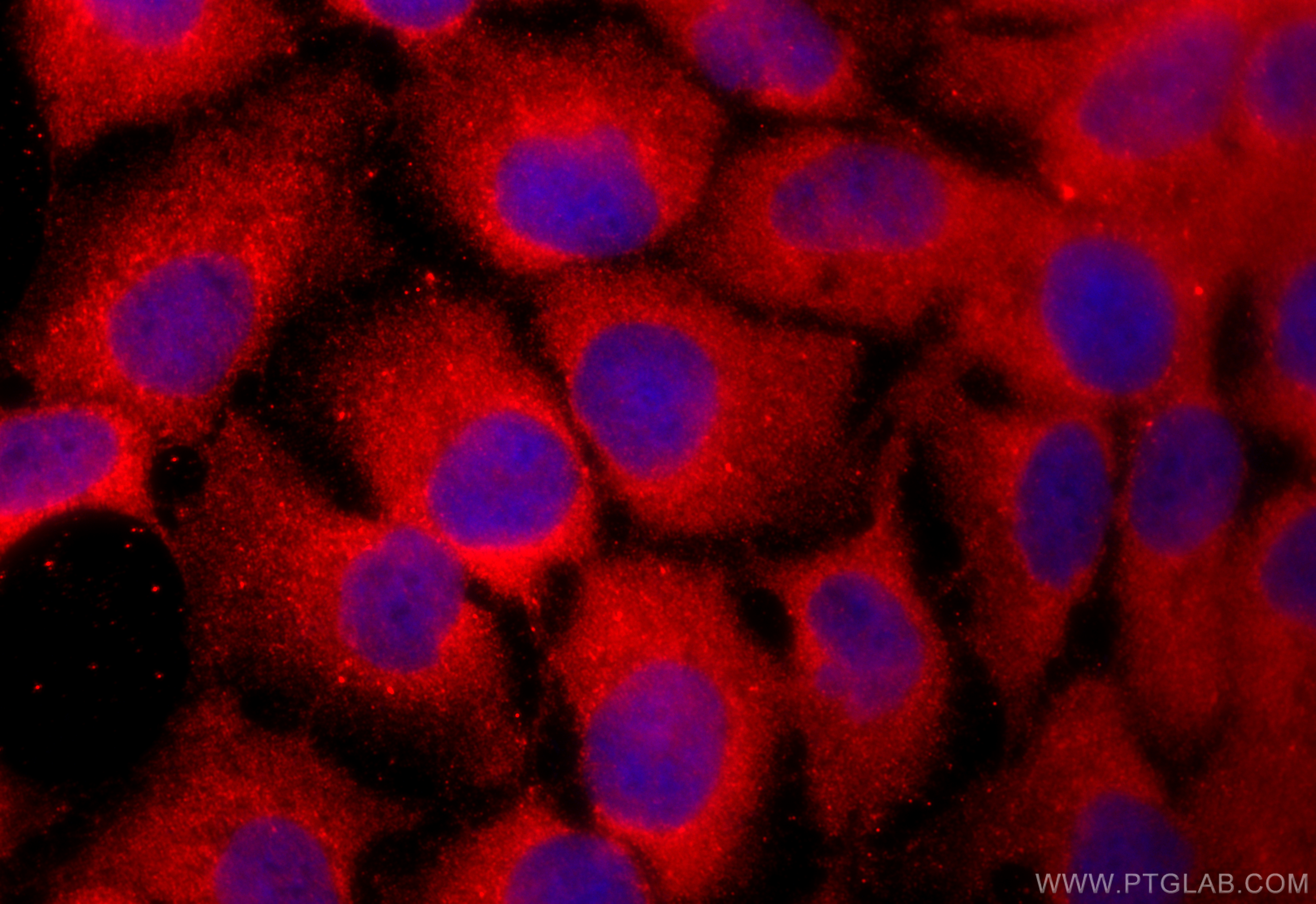 IF Staining of HaCaT using 11077-1-AP