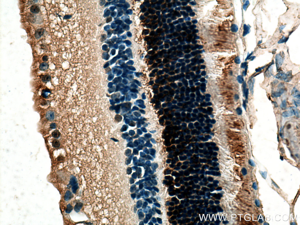 IHC staining of mouse eye using 13289-3-AP