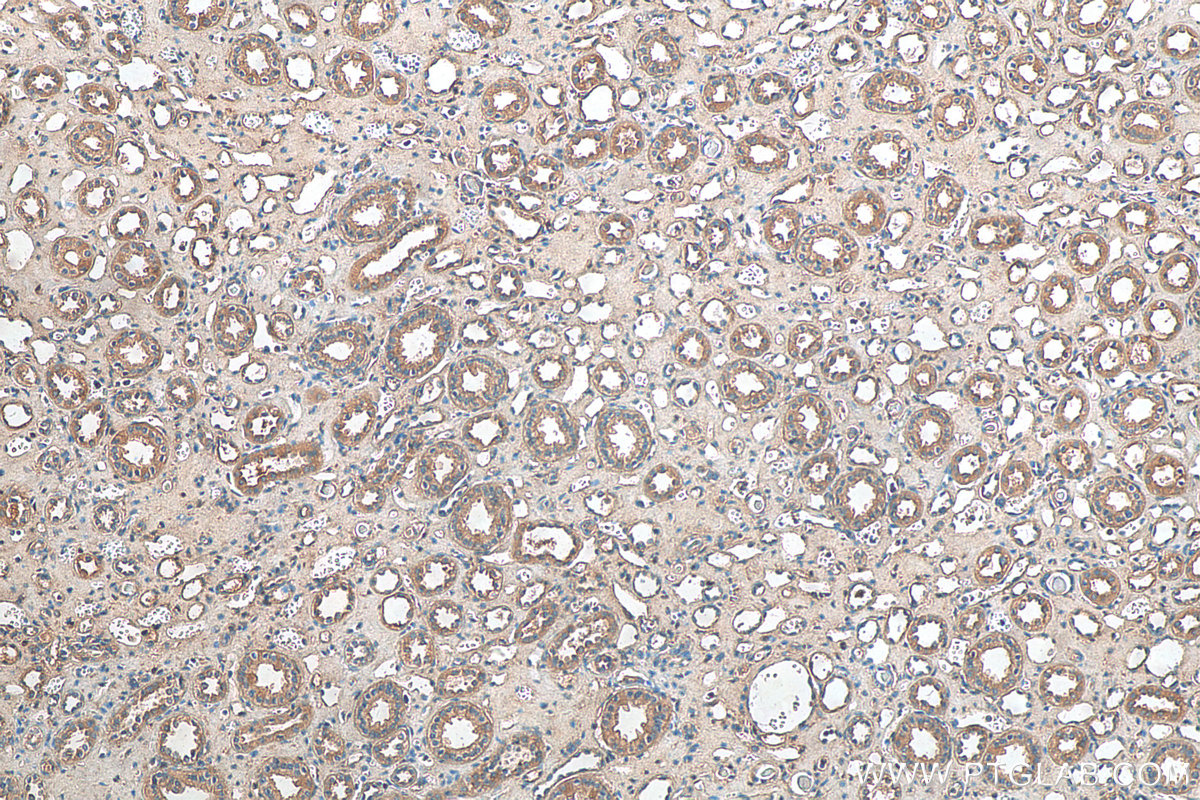 IHC staining of human kidney using 16283-1-AP