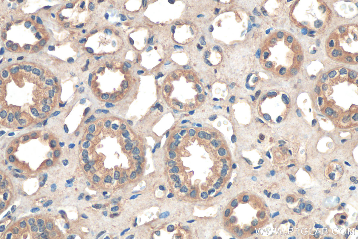 IHC staining of human kidney using 16283-1-AP