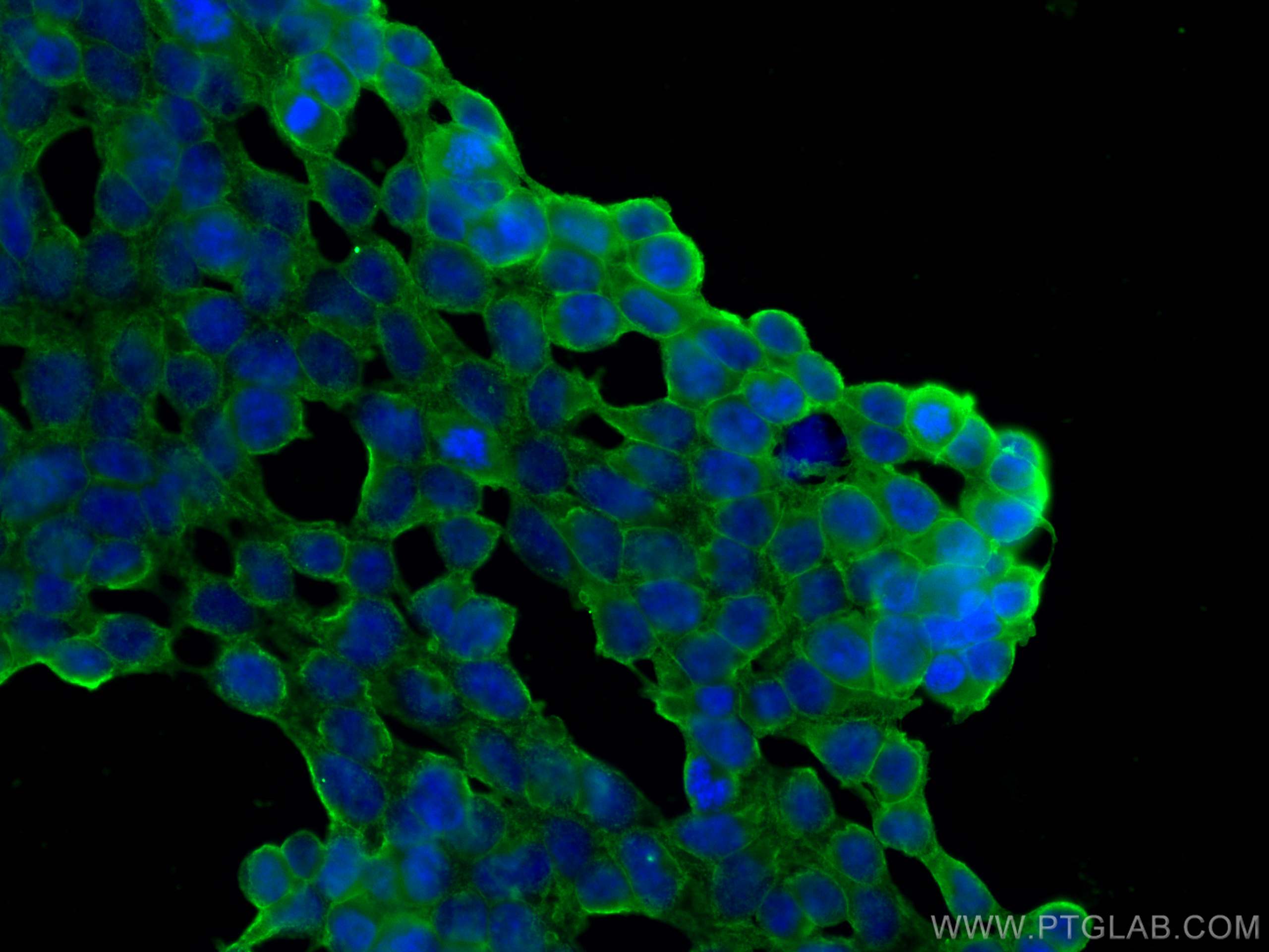 IF Staining of HEK-293 using 68540-1-Ig (same clone as 68540-1-PBS)