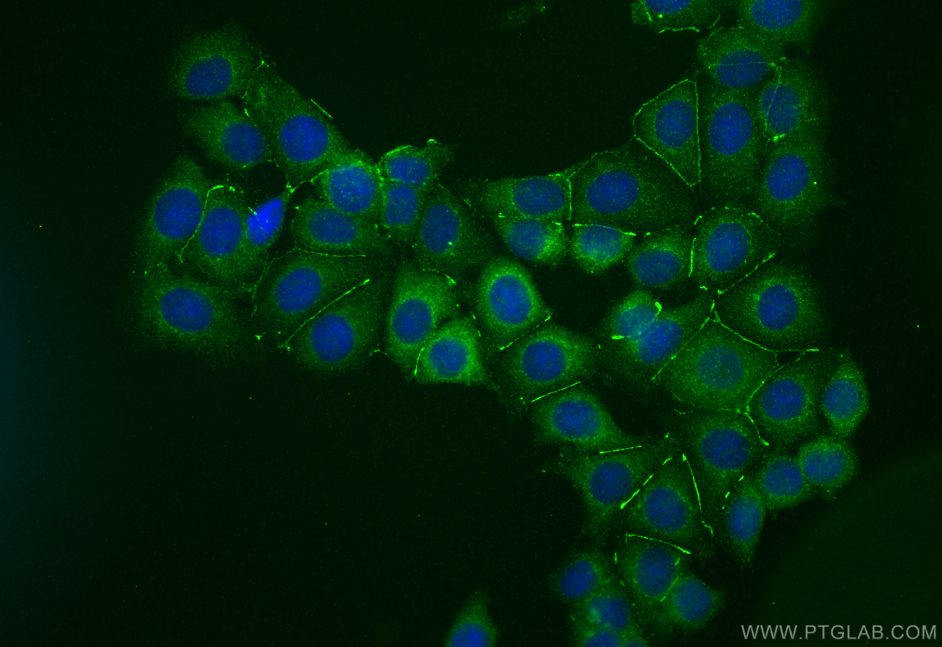 IF Staining of MCF-7 using 13790-1-AP