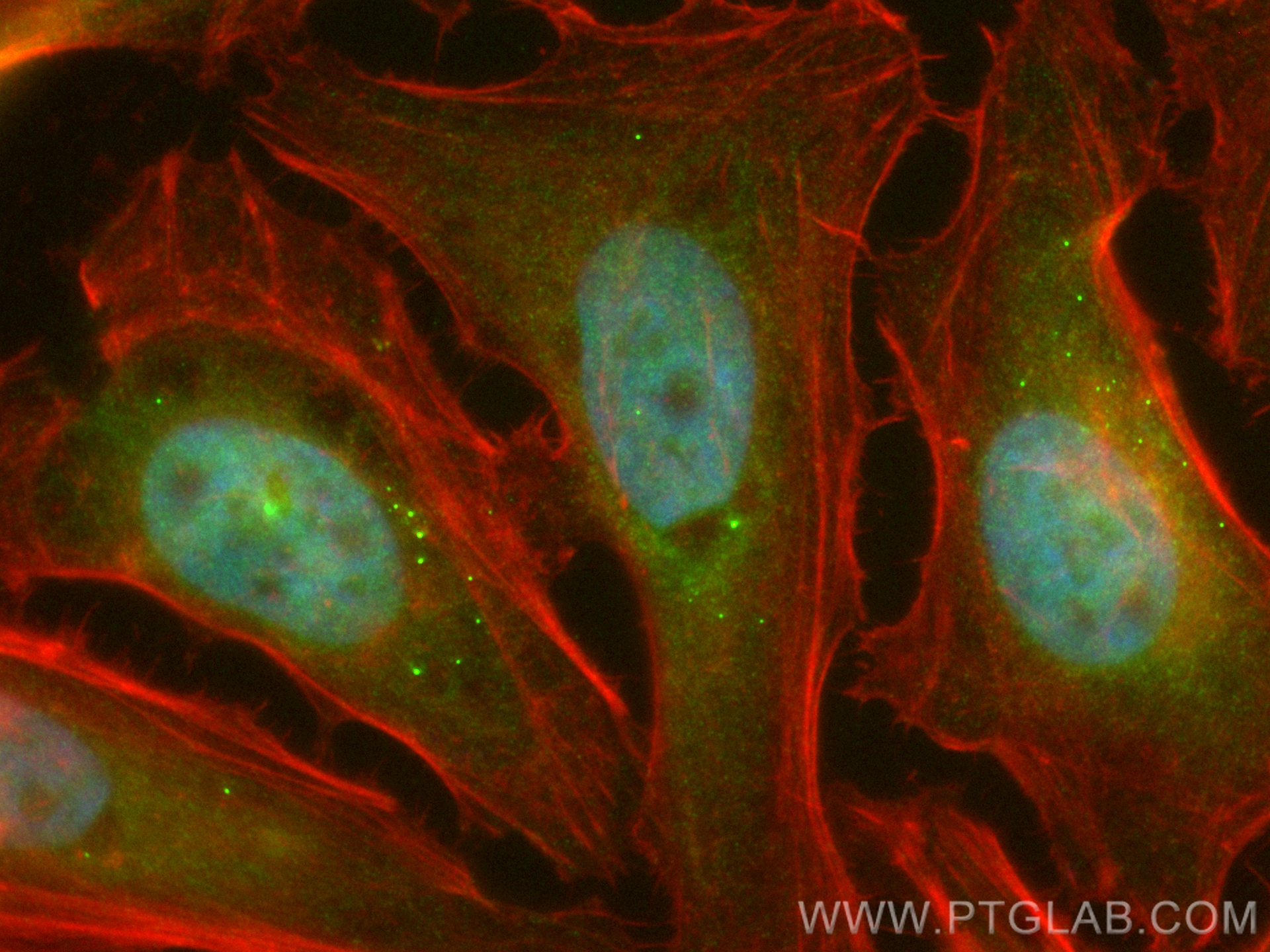 IF Staining of HeLa using CL488-17008