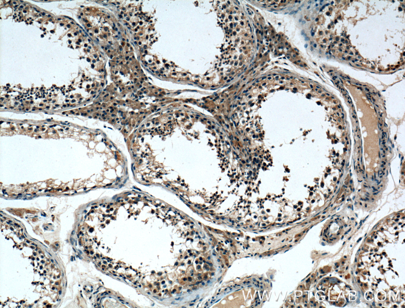 IHC staining of human testis using 26650-1-AP