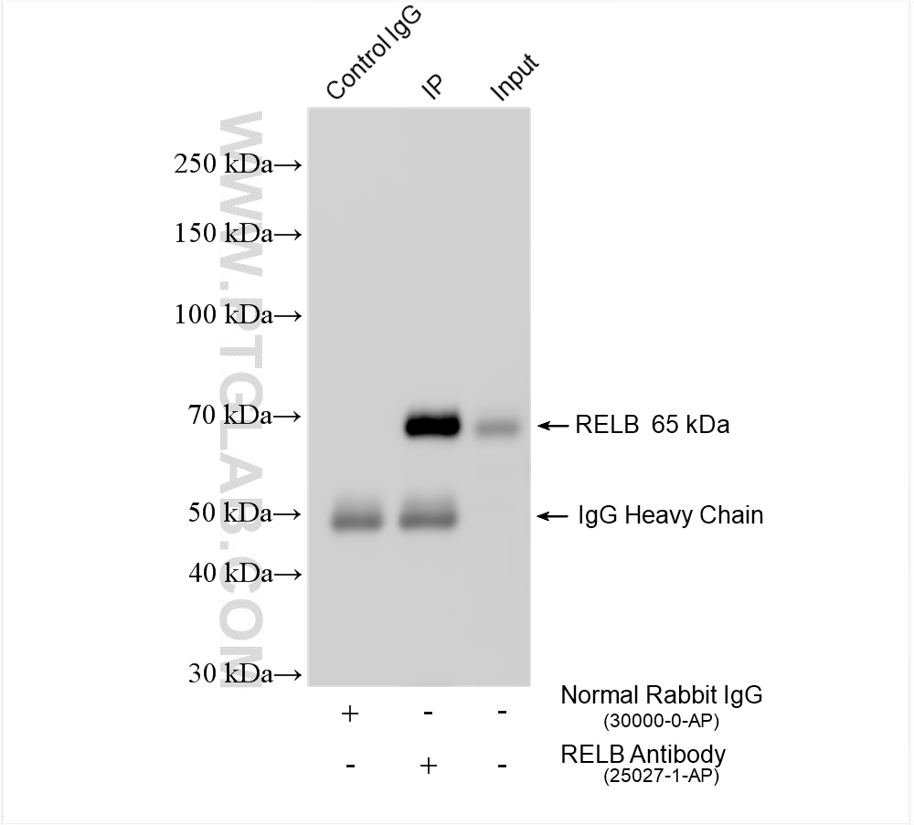 IP experiment of Raji using 25027-1-AP