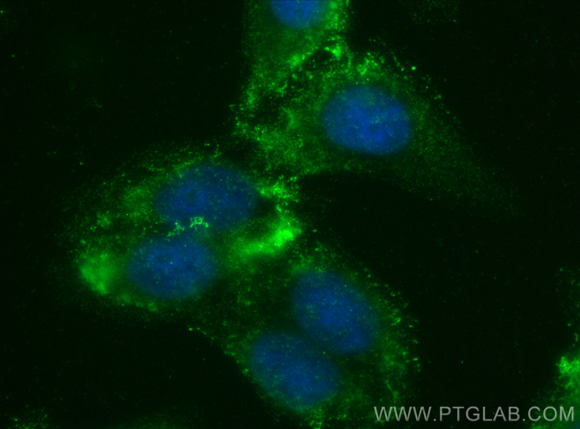 IF Staining of HepG2 using 29330-1-AP