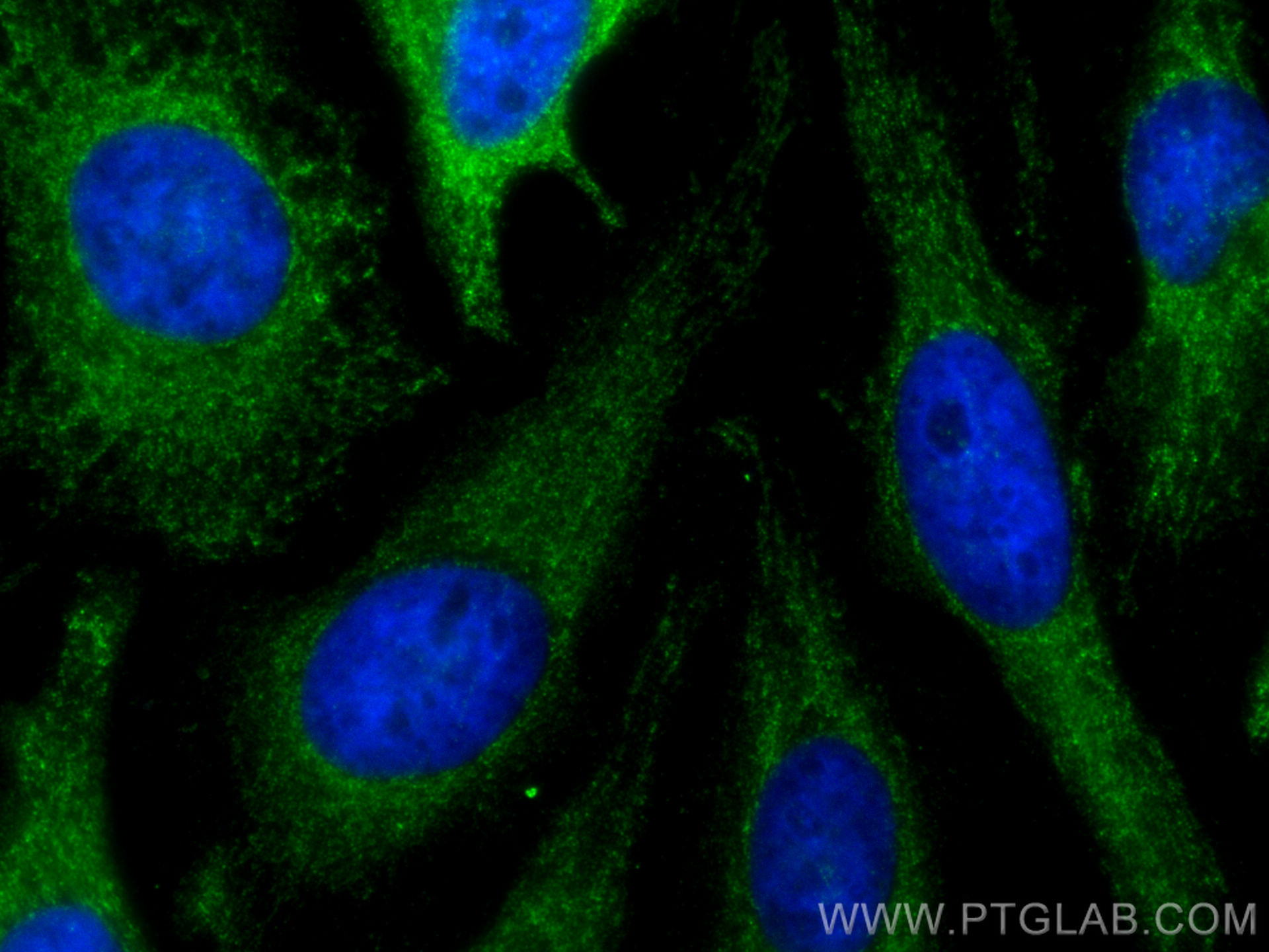 IF Staining of HeLa using 10926-1-AP