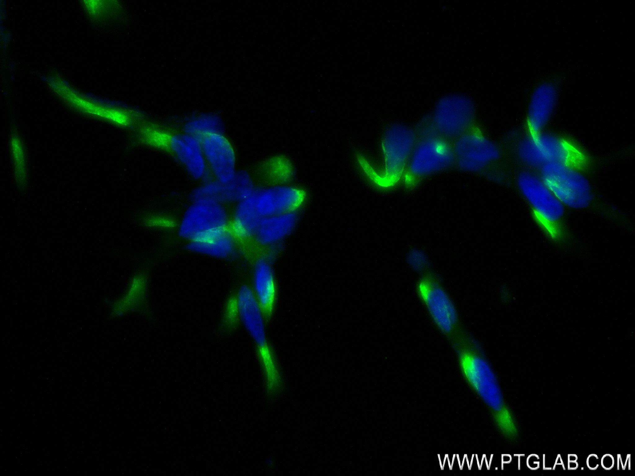 IF Staining of LNCaP using 84016-4-RR