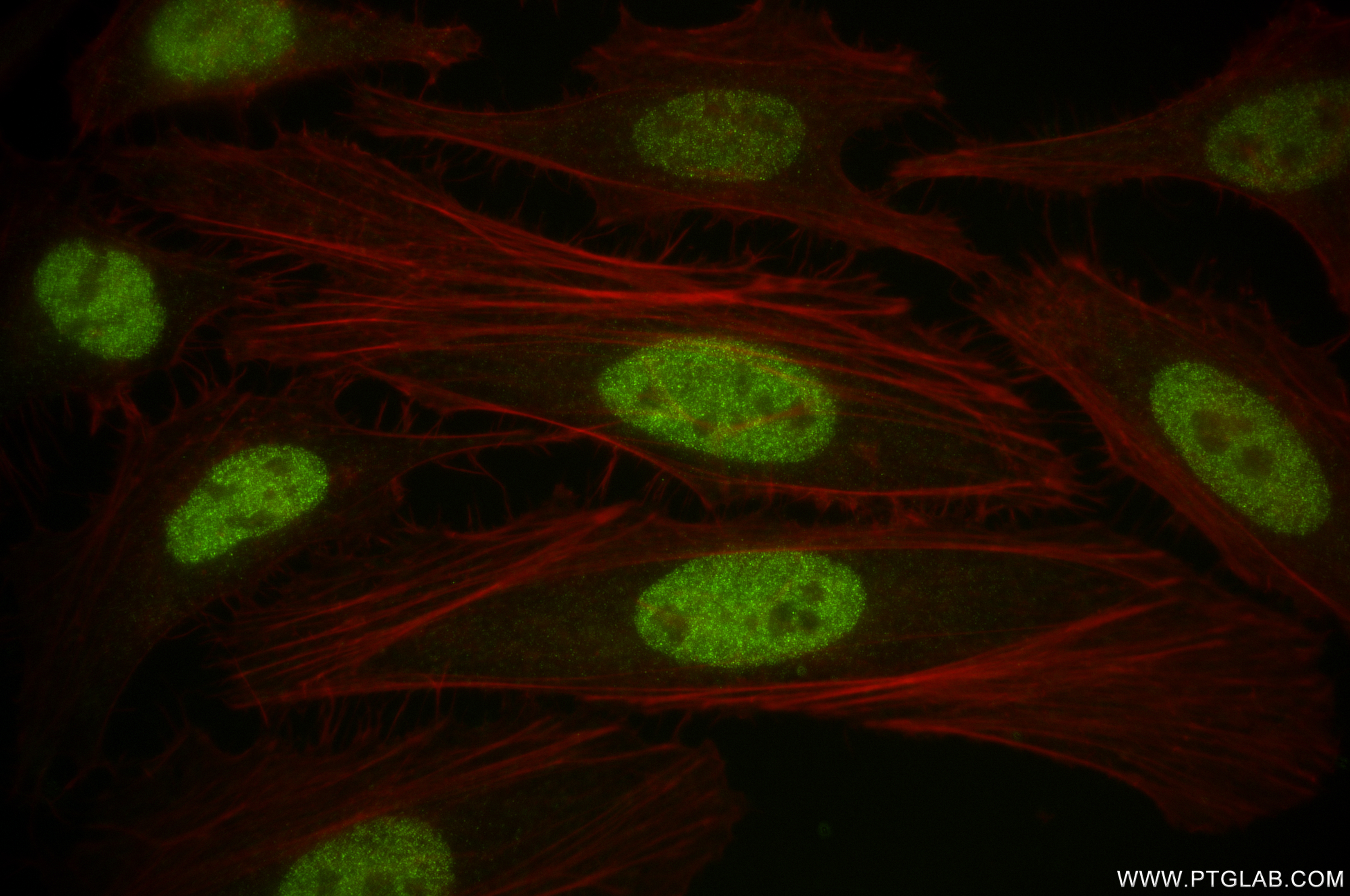 IF Staining of HeLa using 84846-4-RR (same clone as 84846-4-PBS)