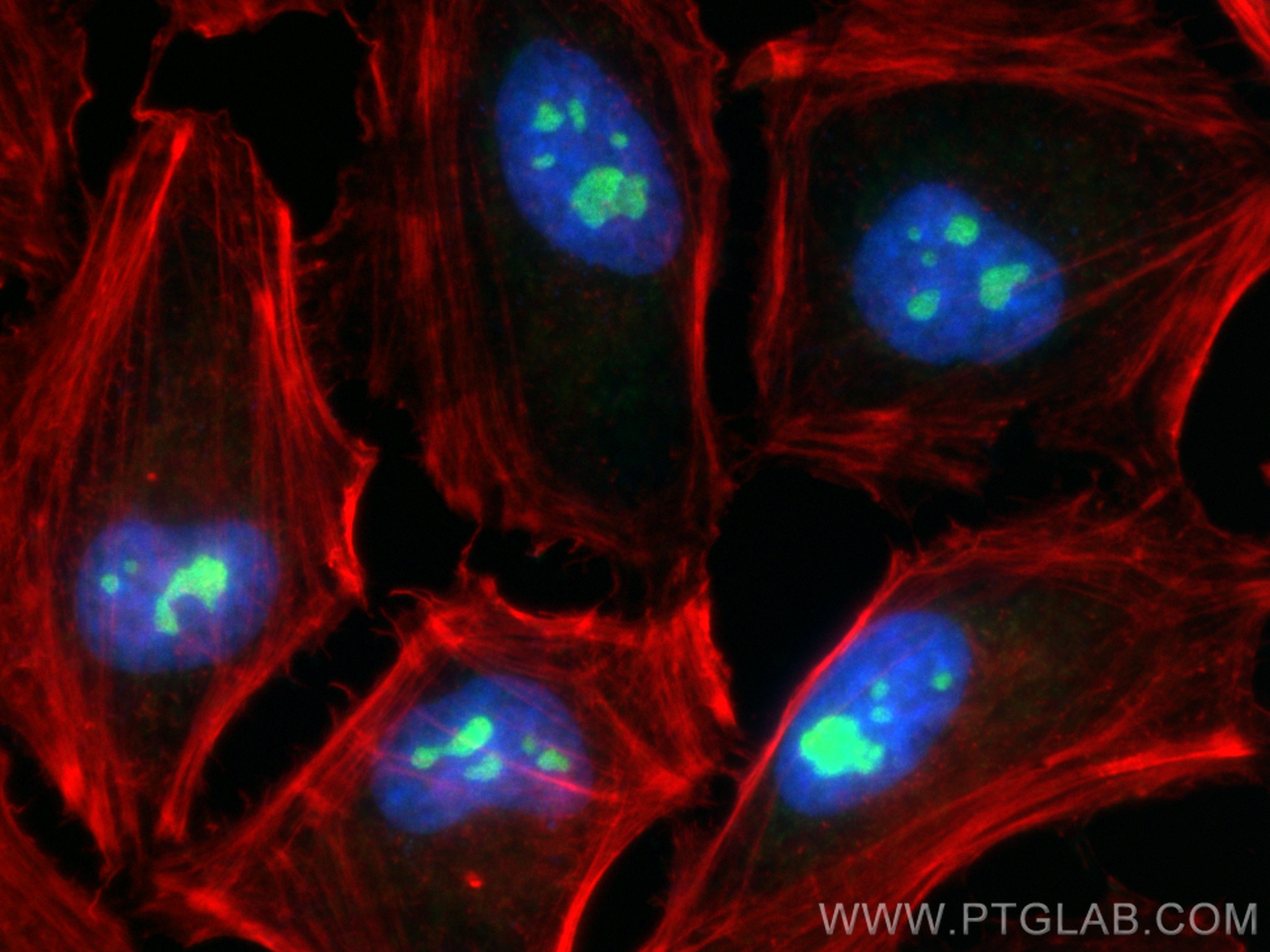 IF Staining of HeLa using 18890-1-AP