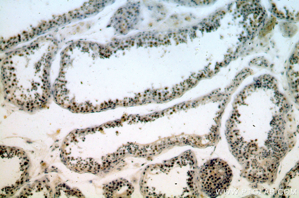 IHC staining of human testis using 18890-1-AP