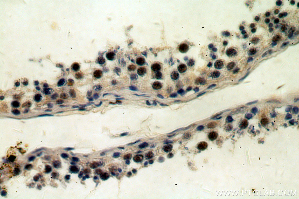 IHC staining of human testis using 18890-1-AP