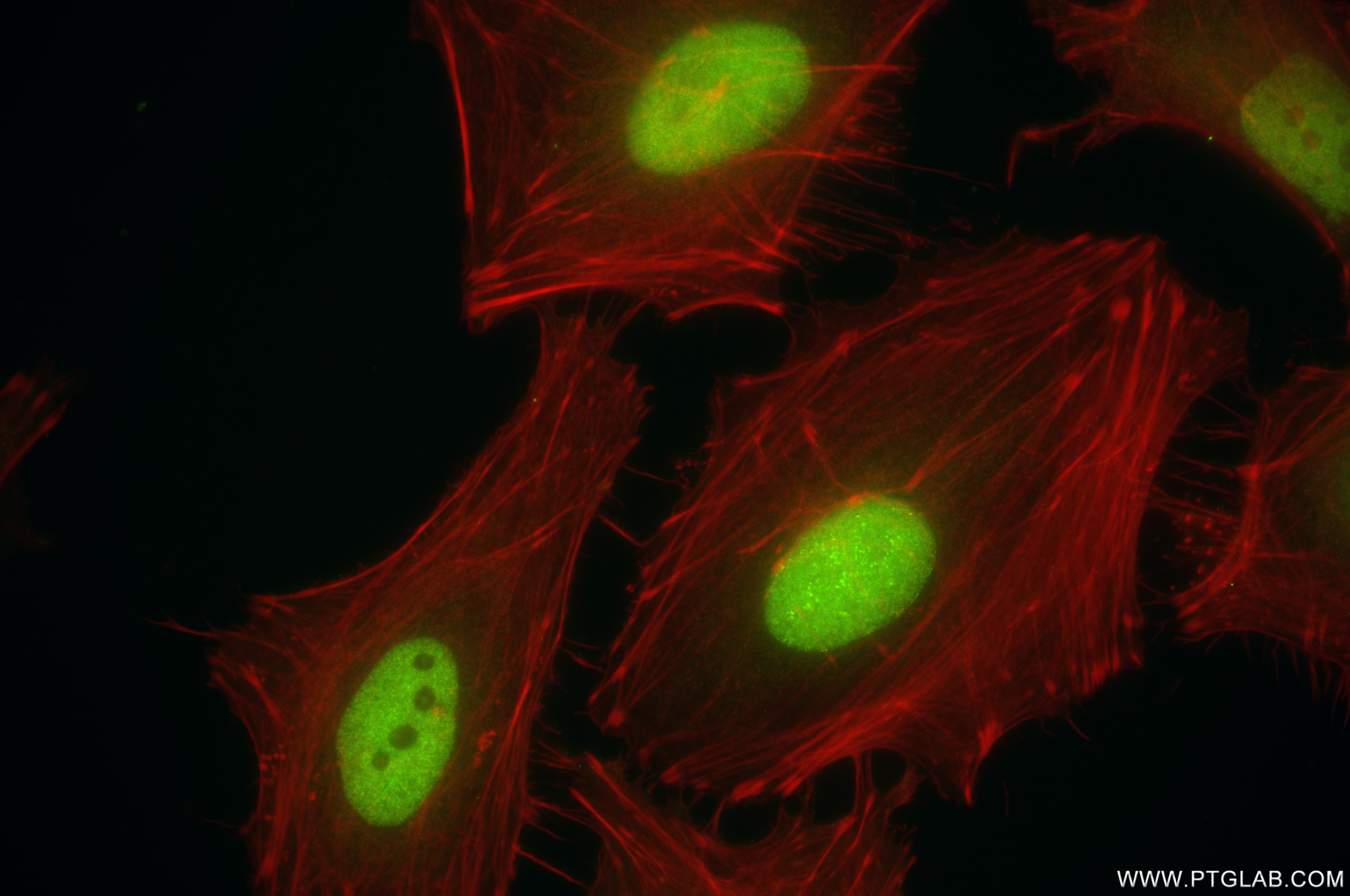 IF Staining of HeLa using 84892-1-RR