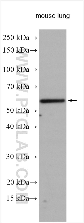 WB analysis using 17854-1-AP