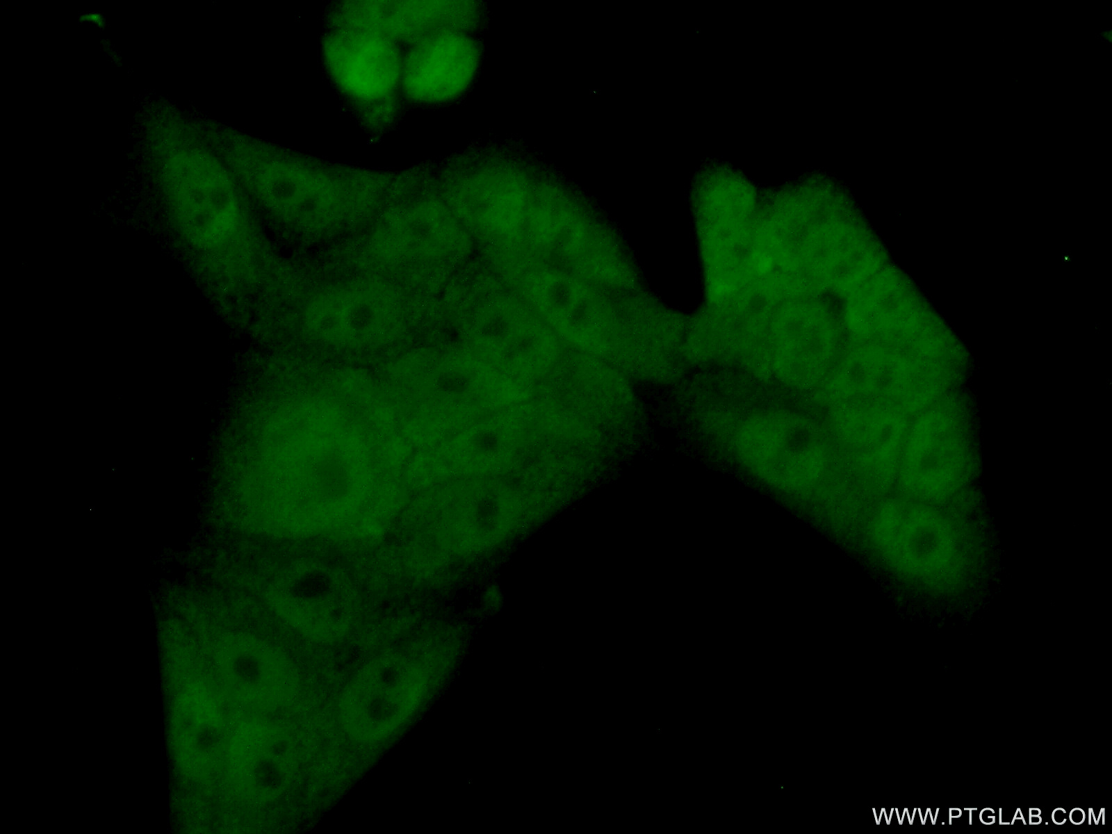 IF Staining of HeLa using 20188-1-AP