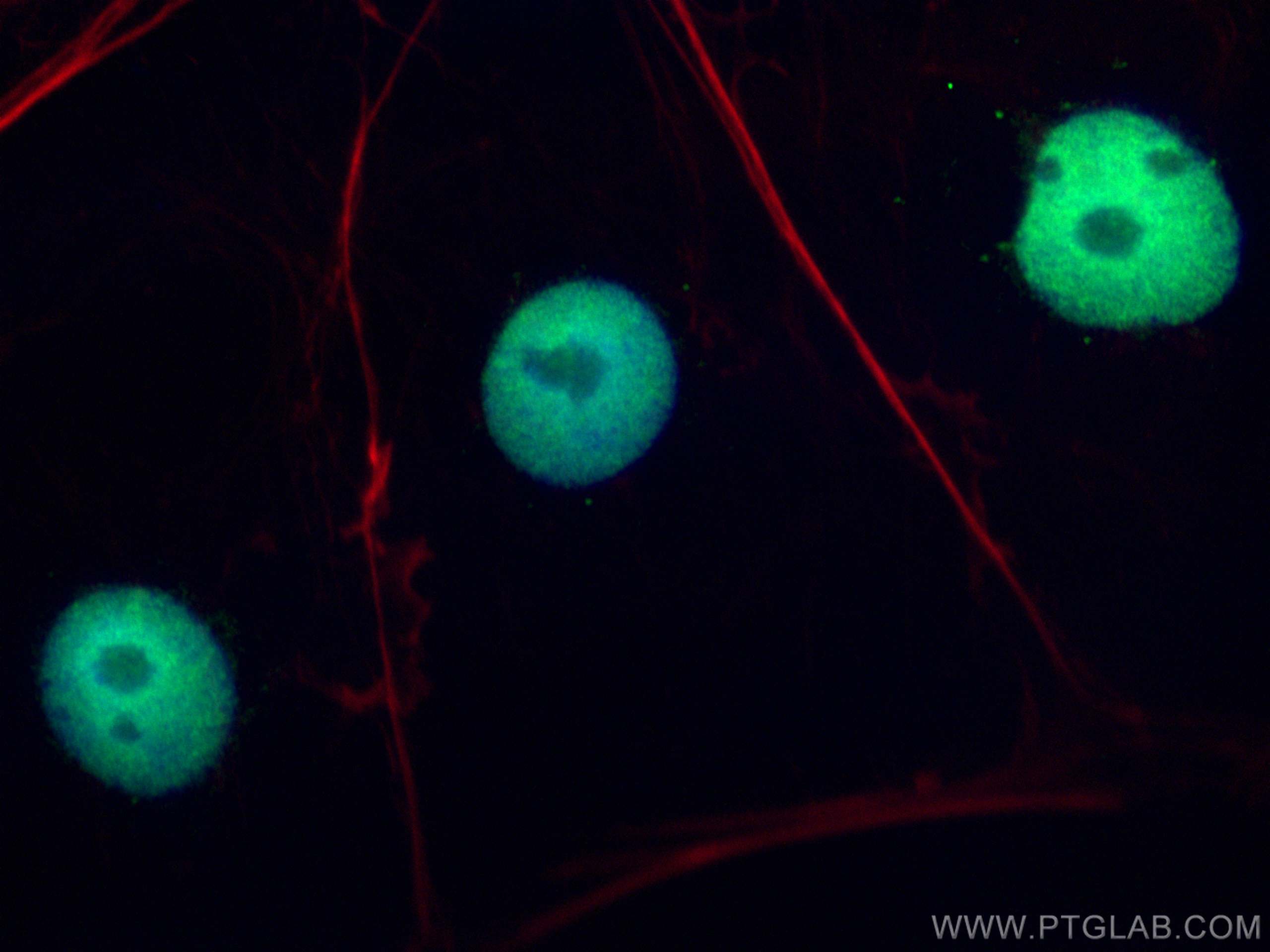 IF Staining of Caco-2 using 19556-1-AP