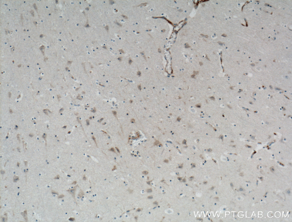 IHC staining of human brain using 12387-1-AP