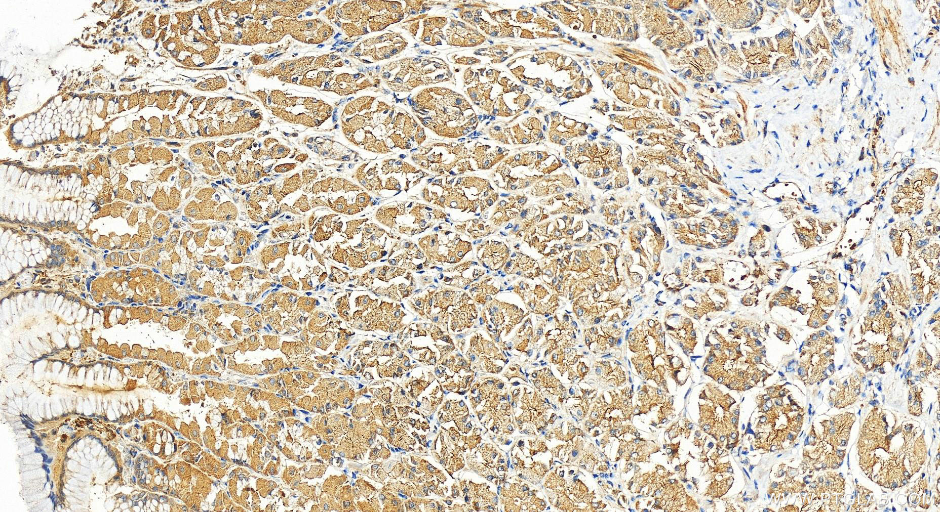 IHC staining of human stomach using 11163-1-AP