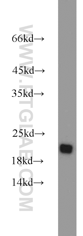 WB analysis of mouse thymus using 11163-1-AP