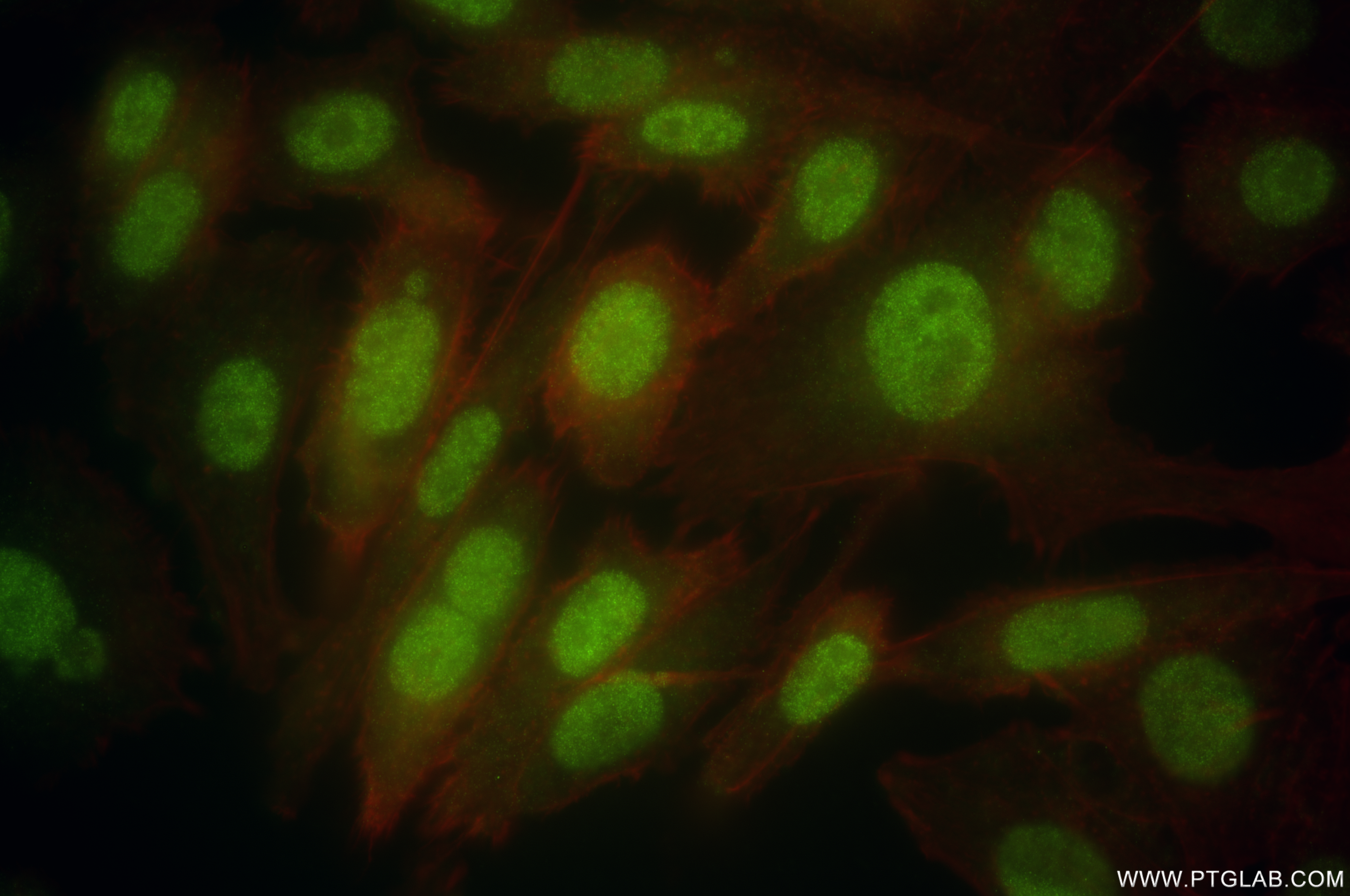 IF Staining of PC-3 using 85057-2-RR (same clone as 85057-2-PBS)