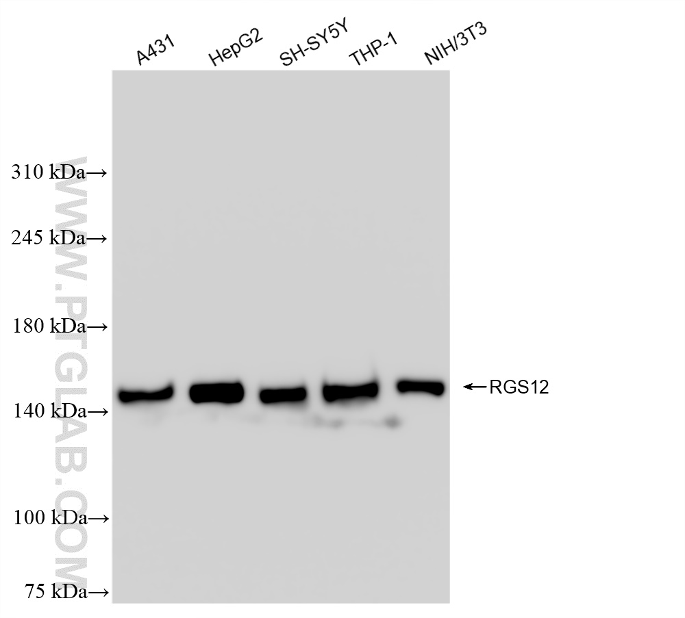 WB analysis using 85057-2-RR (same clone as 85057-2-PBS)