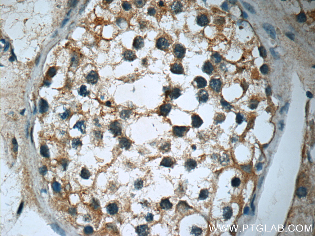 IHC staining of human testis using 12549-1-AP