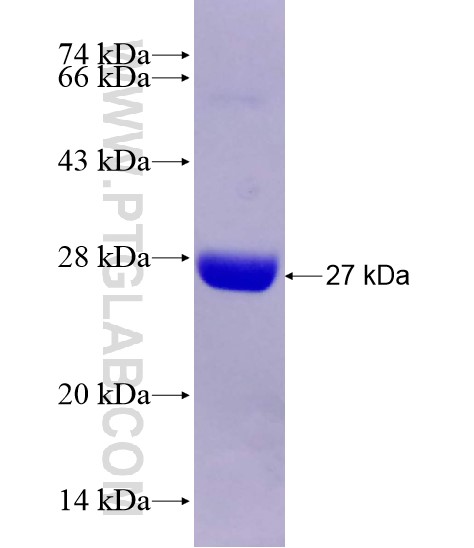 RGS5 fusion protein Ag28806 SDS-PAGE