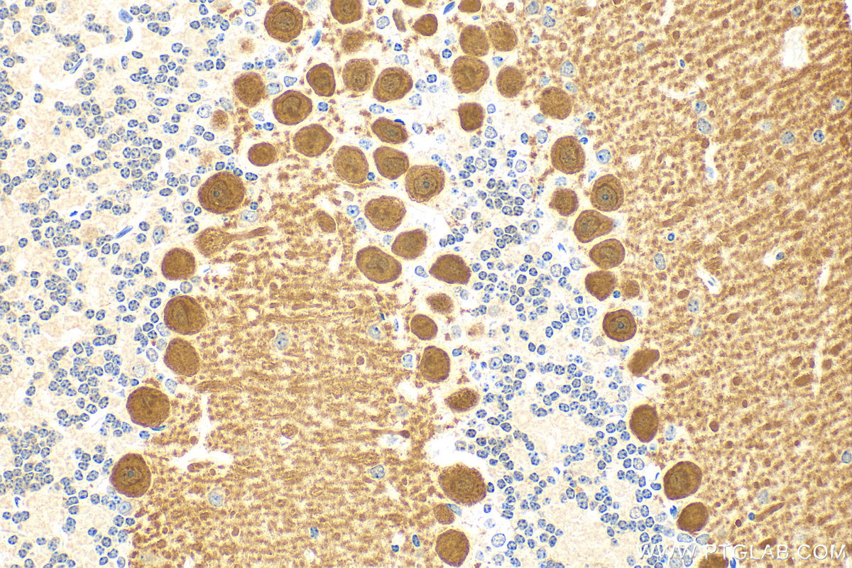 IHC staining of mouse cerebellum using 27394-1-AP