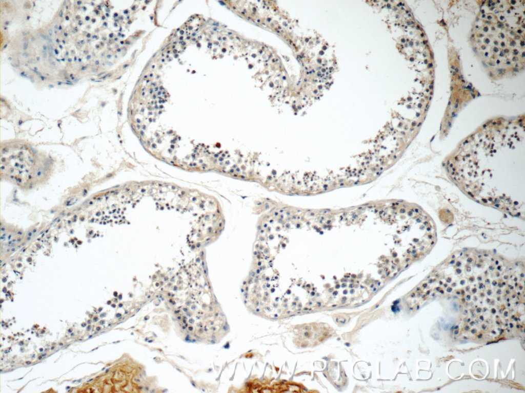 IHC staining of human testis using 25836-1-AP