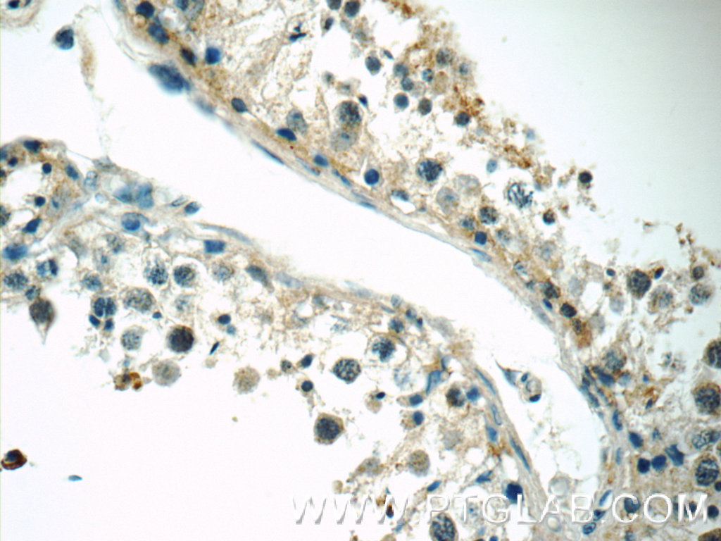 IHC staining of human testis using 25836-1-AP