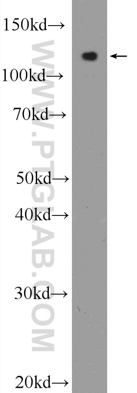 WB analysis of mouse brain using 25836-1-AP